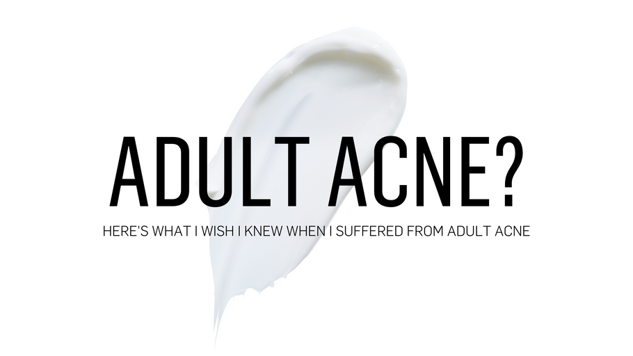 What I wish I knew when I suffered from adult acne