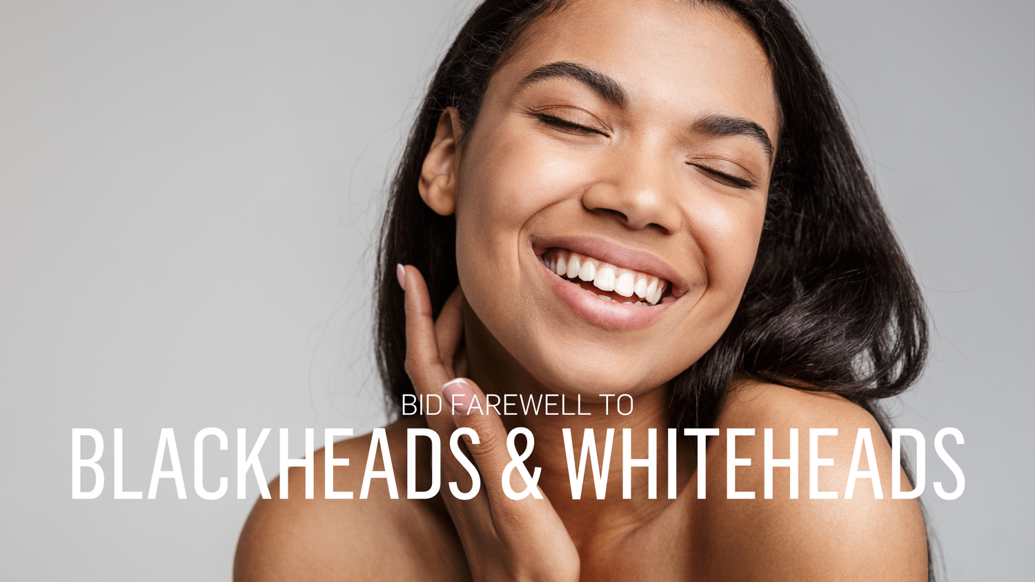 Bid Farewell to Blackheads and Whiteheads